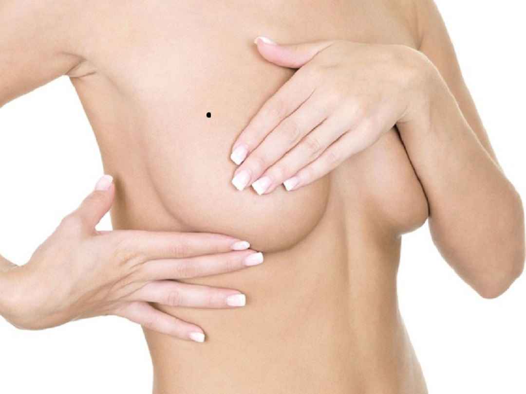 Cách hóa giải nốt ruồi xấu ở ngực